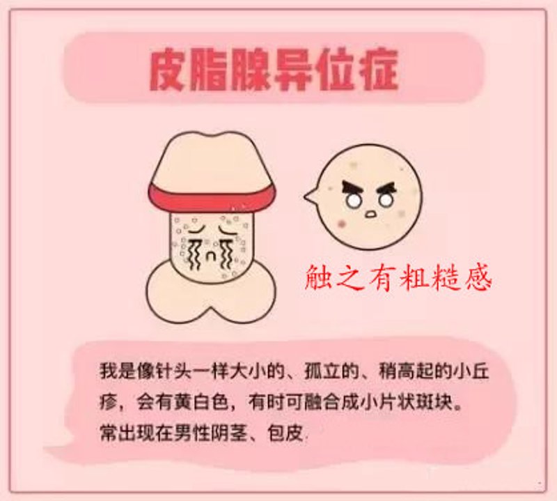 在选择泌尿外科医院时,患者常常会感到迷茫。如何判断哪家医院才是最好的?今天我们就来深度剖析长沙五洲泌尿专科医院,看看它是否值得你信赖。