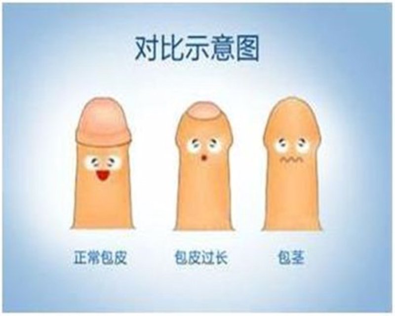 在日常生活中,男性朋友们可能会遇到需要进行男科体检的情况。为了更好地了解自身健康状况,很多人会希望查看自己的男科体检报告单图片。今天我们就来聊聊如何获取和解读这些报告单。